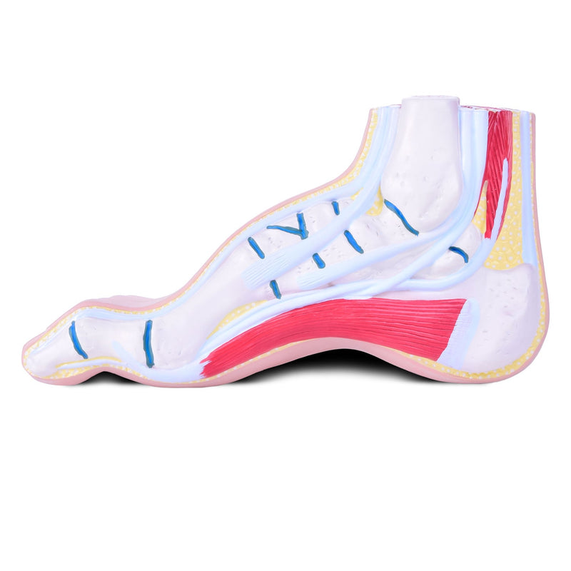 HeineScientific Foot Malpositions Anatomical Model Set