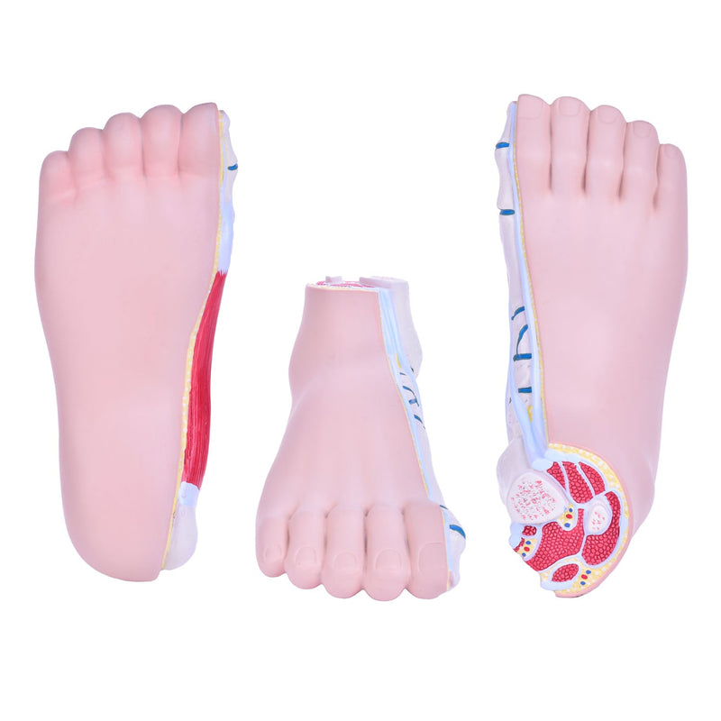 HeineScientific Foot Malpositions Anatomical Model Set