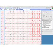 Labtech EC-12R PC Resting ECG