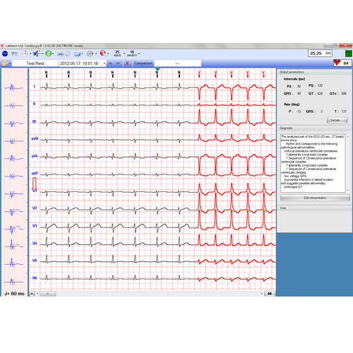 Labtech EC-12R PC Resting ECG