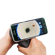 DermoScan Smartphone Adapter for Illuco IDS-1100 Dermatoscope