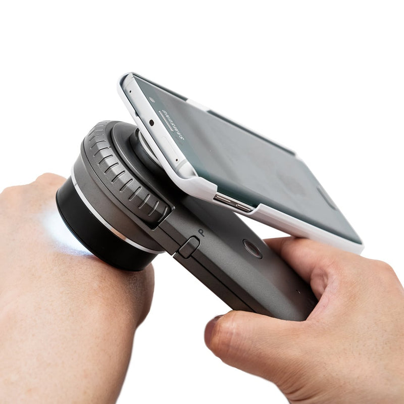 DermoScan Smartphone Adapter for Illuco IDS-1100 Dermatoscope