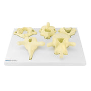 HeineScientific Vertebrae Types Anatomical Model