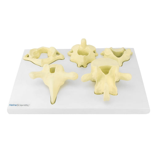 HeineScientific Vertebrae Types Anatomical Model