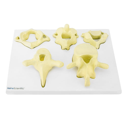 HeineScientific Vertebrae Types Anatomical Model
