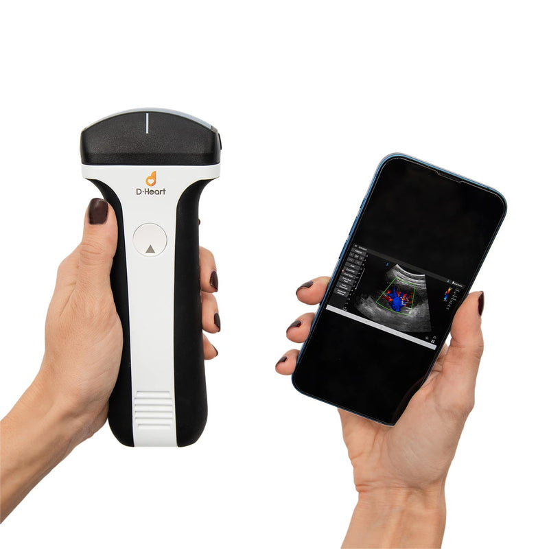 D-Heart Handheld Ultrasound Scanner with Probes