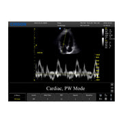 Chison ECO3 Expert Ultrasound Machine