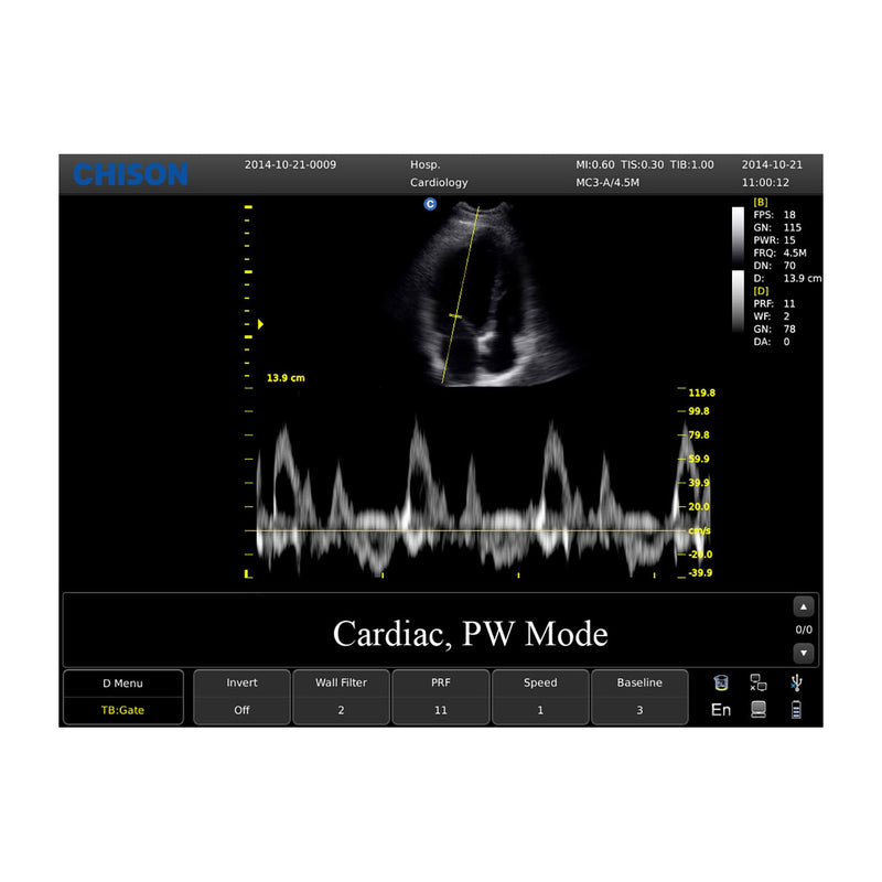 Chison ECO3 Expert Ultrasound Machine