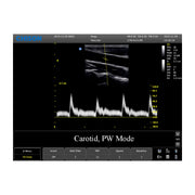 Chison ECO3 Expert Ultrasound Machine