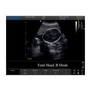 Chison ECO3 Expert Ultrasound Machine