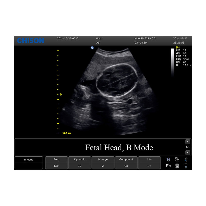Chison ECO3 Expert Ultrasound Machine