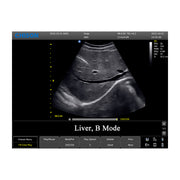 Chison ECO3 Expert Ultrasound Machine
