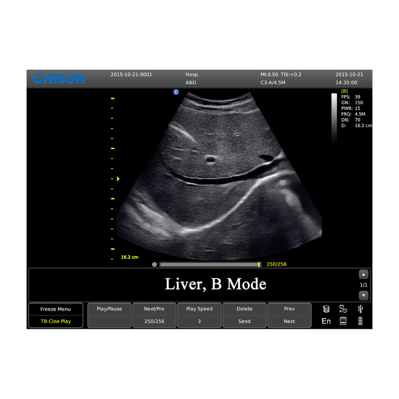 Chison ECO3 Expert Ultrasound Machine