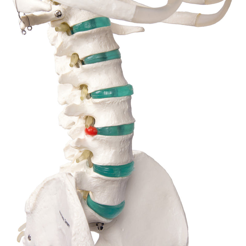 Erler-Zimmer Oscar School Skeleton Model with Rolling Stand