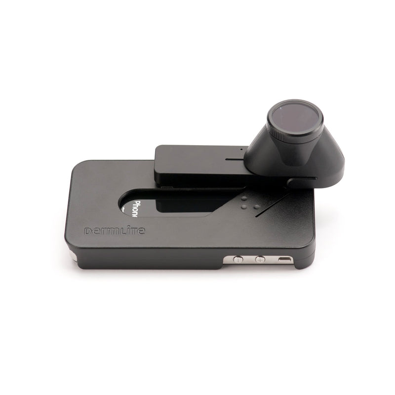 DermLite DL1 Dermatoscope with LED Illumination