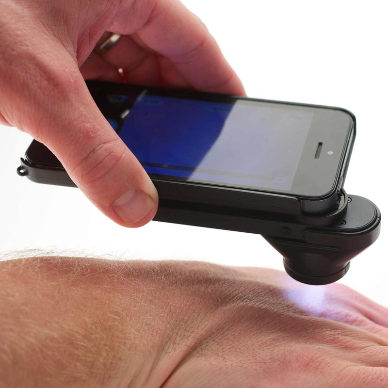 DermLite DL1 Dermatoscope with LED Illumination