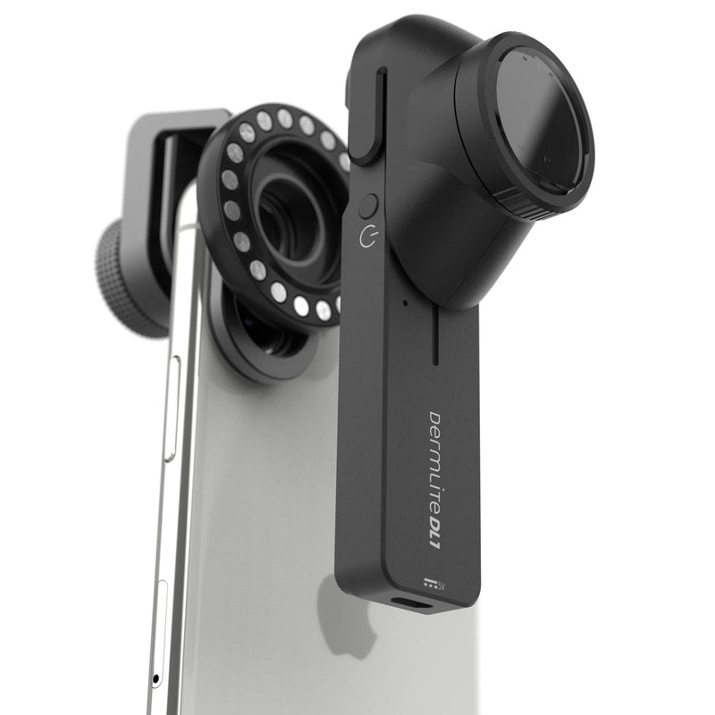 DermLite DL1 Dermatoscope with LED Illumination