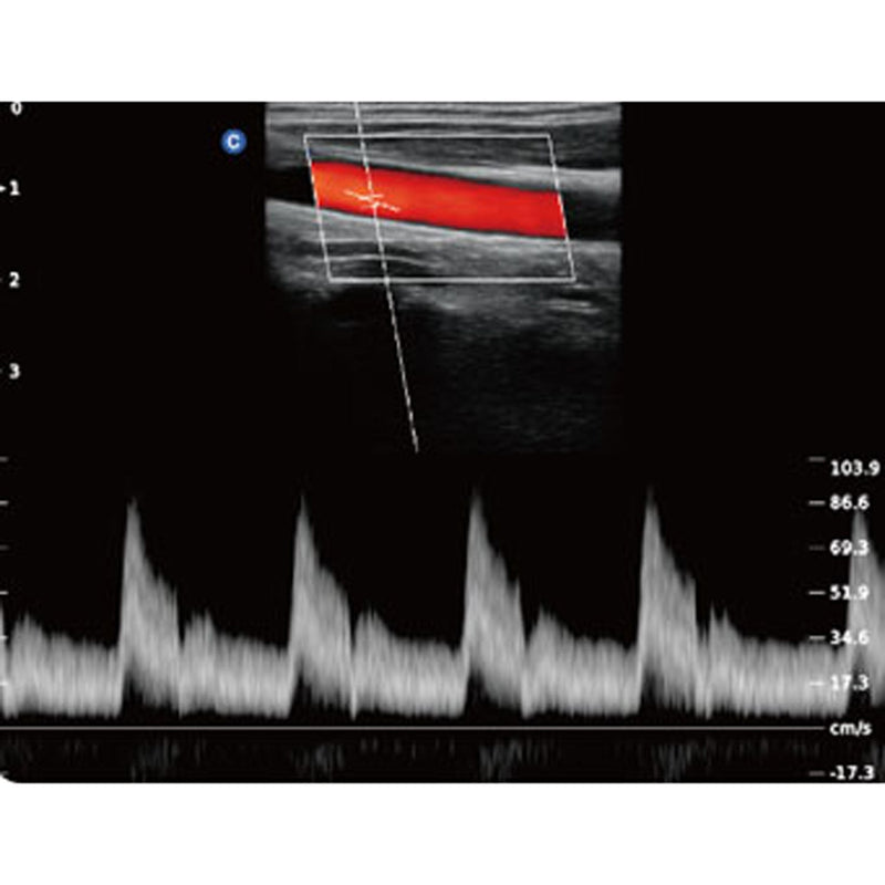 Chison QBit5 Ultrasound Machine with 19-Inch LED Monitor