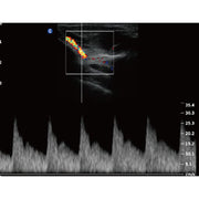 Chison QBit5 Ultrasound Machine with 19-Inch LED Monitor