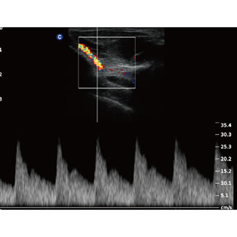 Chison QBit5 Ultrasound Machine with 19-Inch LED Monitor