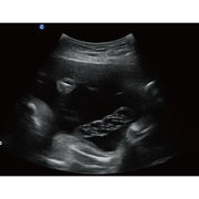 Chison QBit5 Ultrasound Machine with 19-Inch LED Monitor