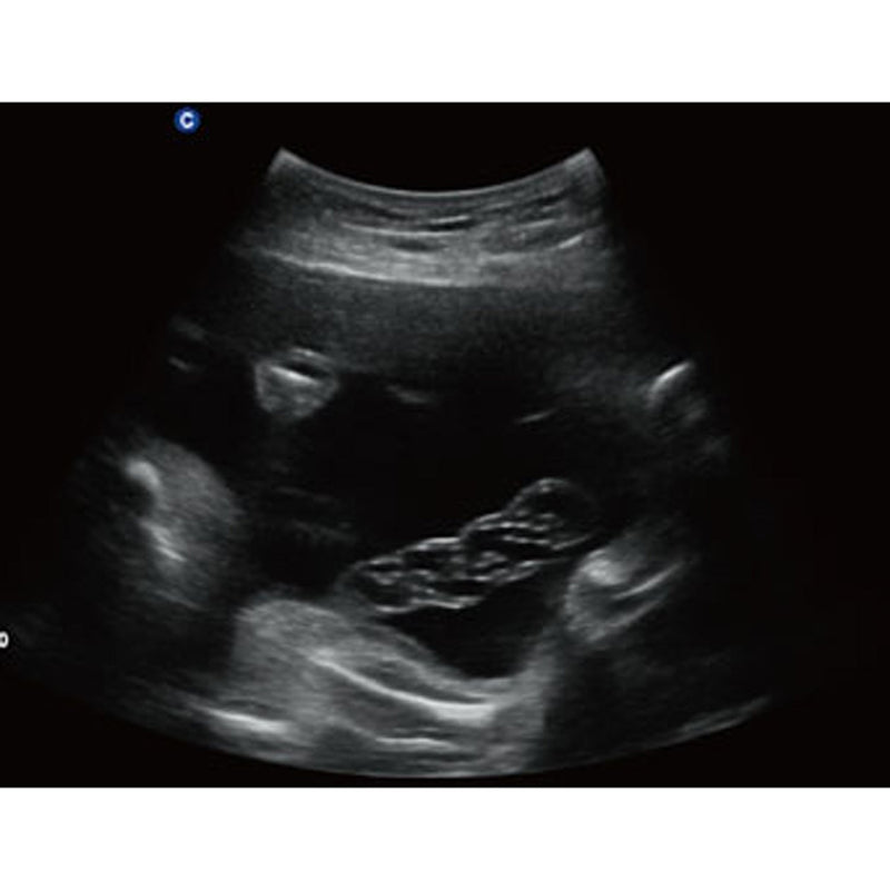 Chison QBit5 Ultrasound Machine with 19-Inch LED Monitor