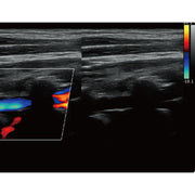 Chison QBit5 Ultrasound Machine with 19-Inch LED Monitor