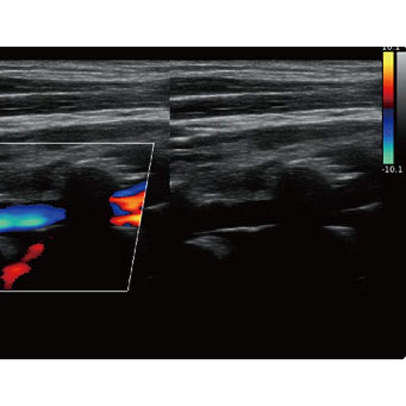 Chison QBit5 Ultrasound Machine with 19-Inch LED Monitor