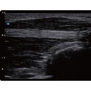 Chison QBit5 Ultrasound Machine with 19-Inch LED Monitor