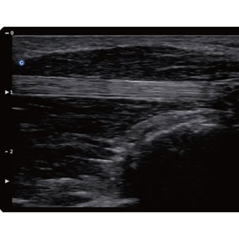 Chison QBit5 Ultrasound Machine with 19-Inch LED Monitor