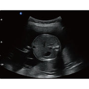 Chison QBit5 Ultrasound Machine with 19-Inch LED Monitor