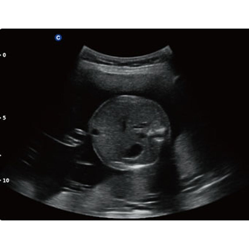 Chison QBit5 Ultrasound Machine with 19-Inch LED Monitor