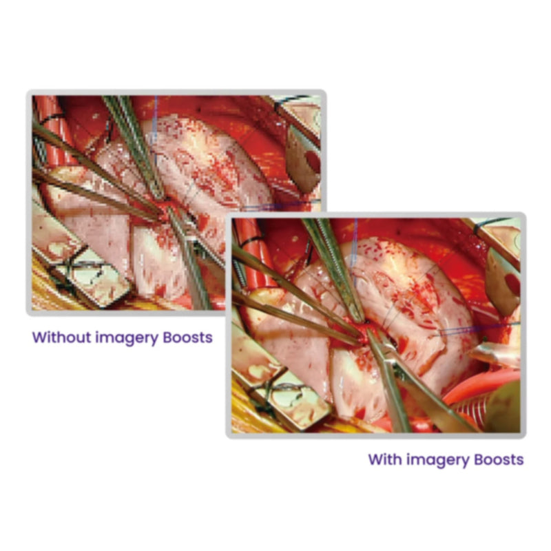 BenQ SE27105 27-Inch Surgical Display High-Bright Full-HD