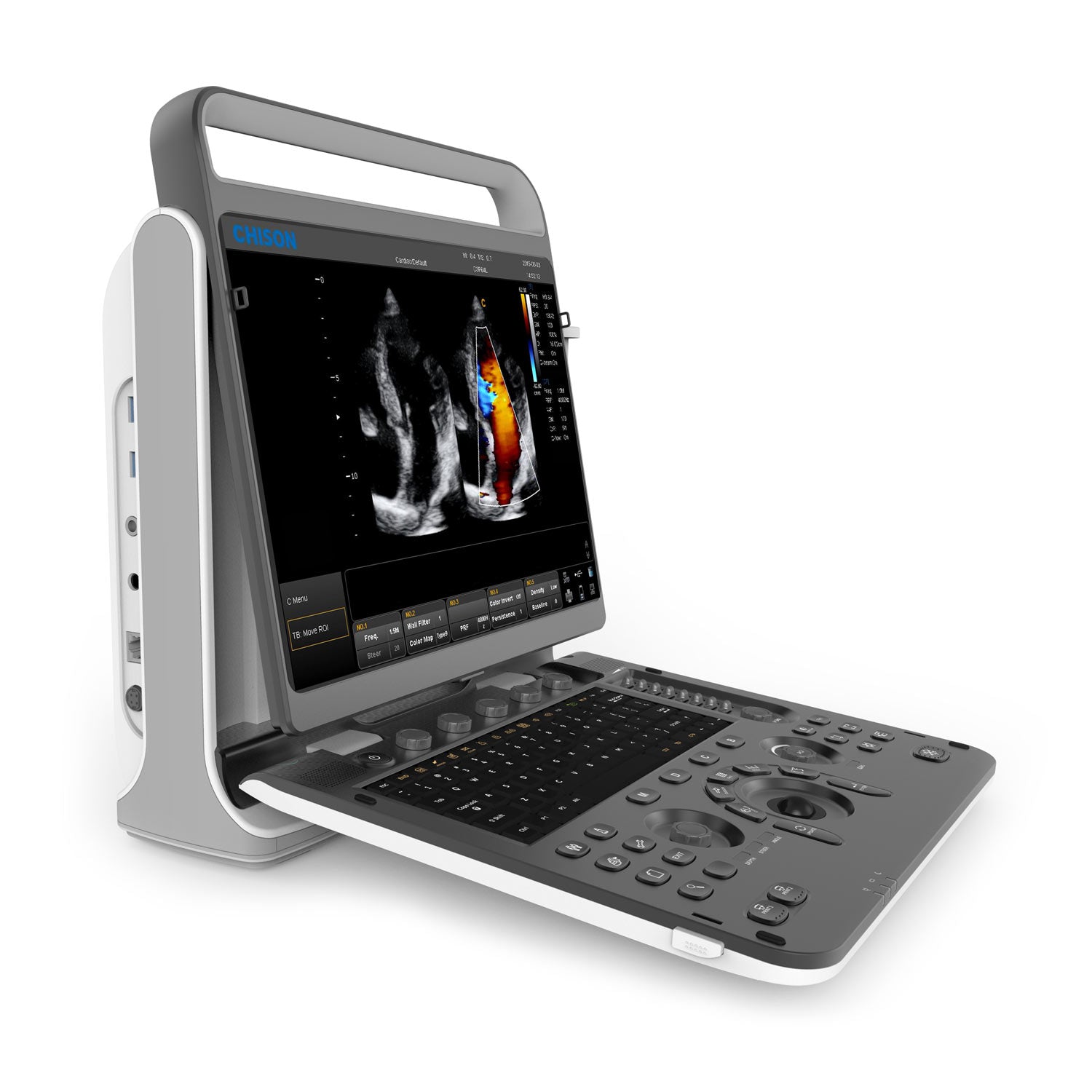 Chison EBit 60 Ultrasound | Portable Imaging | Armoria