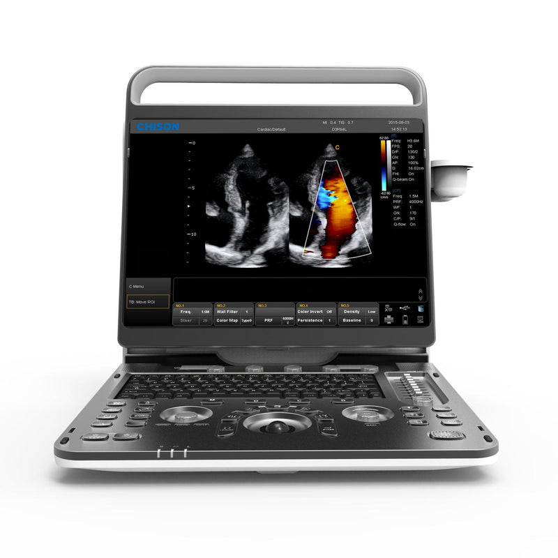 Chison EBit 60 Ultrasound System