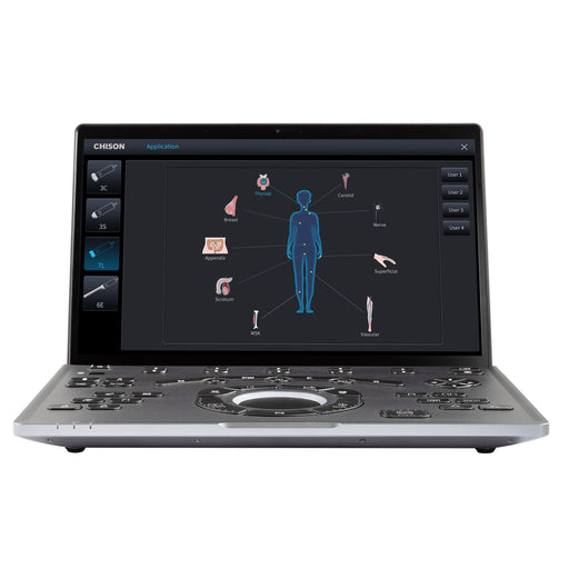 Chison SonoAir 30 Portable Ultrasound System