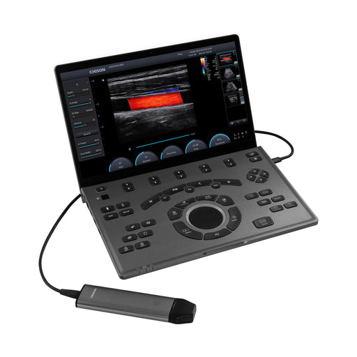 Chison SonoAir 30 Portable Ultrasound System