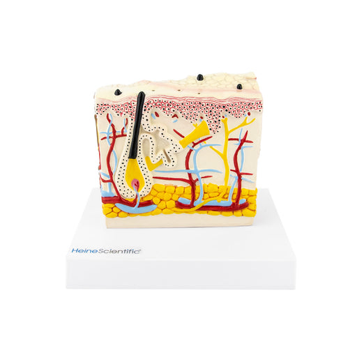 HeineScientific Model Skin with Psoriasis Anatomical Block