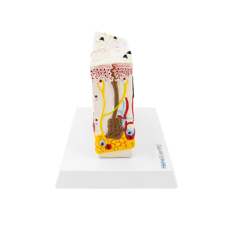 HeineScientific Model Skin with Psoriasis Anatomical Block