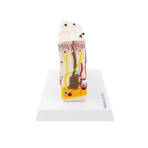 HeineScientific Model Skin with Psoriasis Anatomical Block