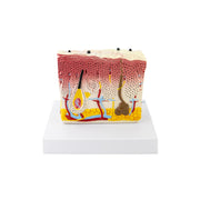 HeineScientific Model Skin with Psoriasis Anatomical Block