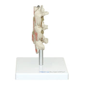 HeineScientific Osteoporosis Model Skeletal Model 3 Vertebrae