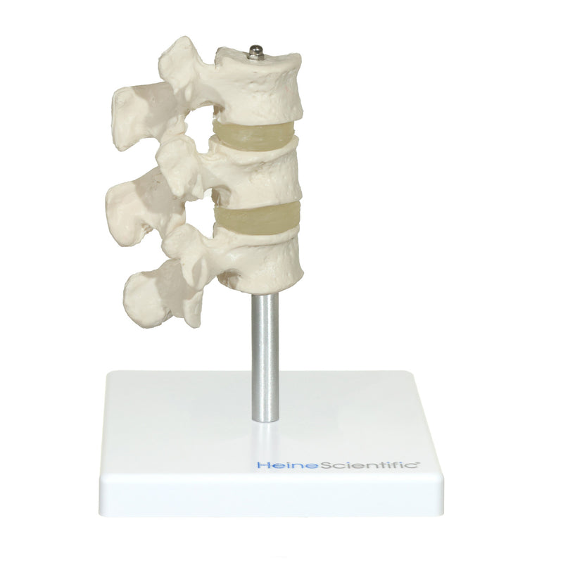 HeineScientific Osteoporosis Model Skeletal Model 3 Vertebrae