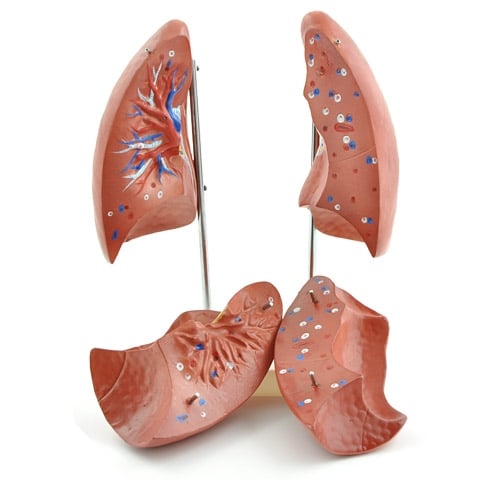 HeineScientific Lung Model with Dismountable Parts