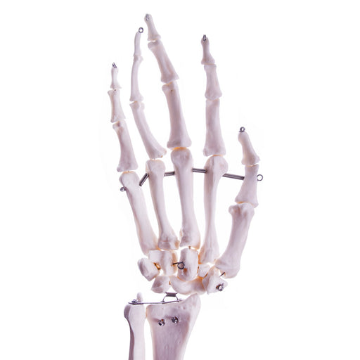 HeineScientific Arm Skeleton Anatomical Model