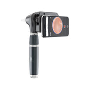 Welch Allyn MacroView Plus Otoscope for iExaminer