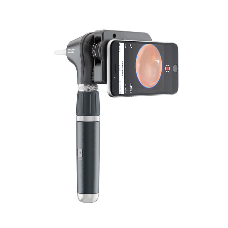 Welch Allyn MacroView Plus Otoscope for iExaminer