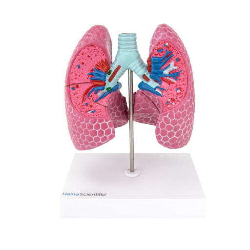 HeineScientific Lung Model with Diseases
