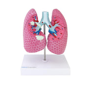 HeineScientific Lung Model with Diseases
