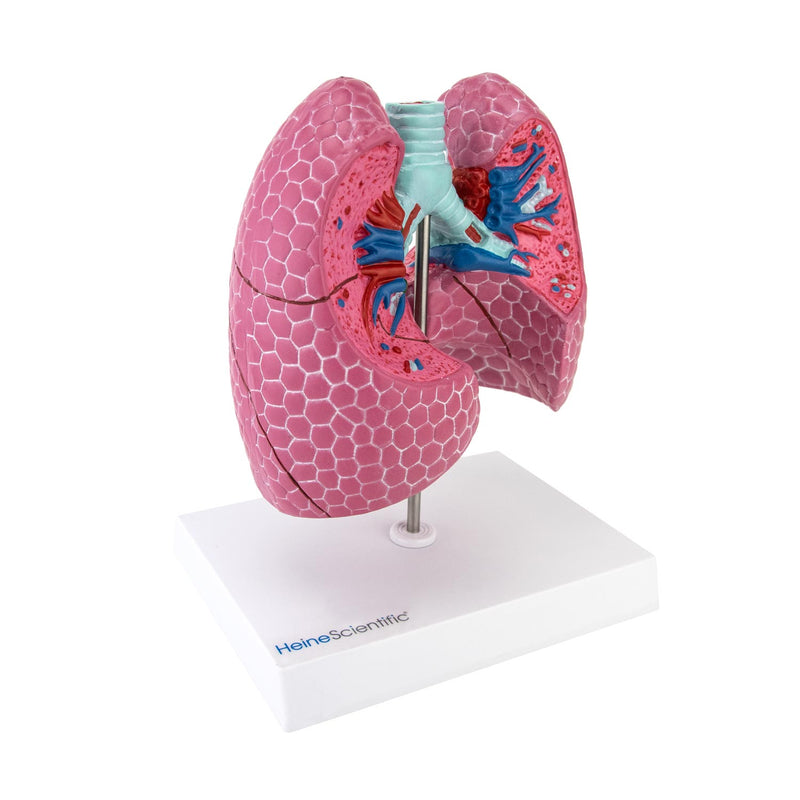 HeineScientific Lung Model with Diseases